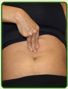 Diastasis Rectus Abdominis and Lumbo-Pelvic Pain and Dysfunction-Are They Related?