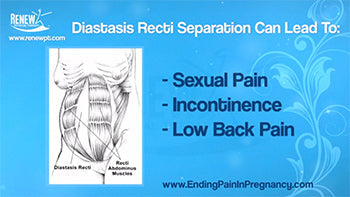 Video Blog: How to Close Your Abdominal Separation for Strength in Labor and Fast Post Partum Recovery
